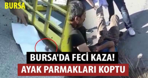 Bursa'da feci kaza! Ayak parmakları koptu