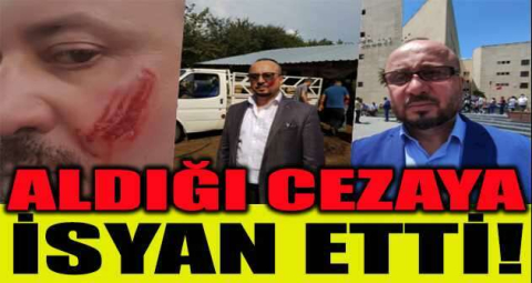 Avukat yanağından ısıran şahsın aldığı cezaya isyan etti